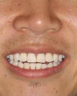 After image 3